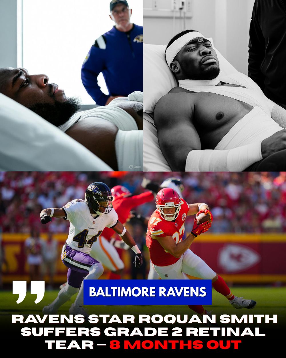 DISASTER IN BALTIMORE: Ravens Star Roquan Smith Suffers Grade 2 Retinal Tear — 8 Months Out, Coach Harbaugh Panics Over Team’s Future! .Vl