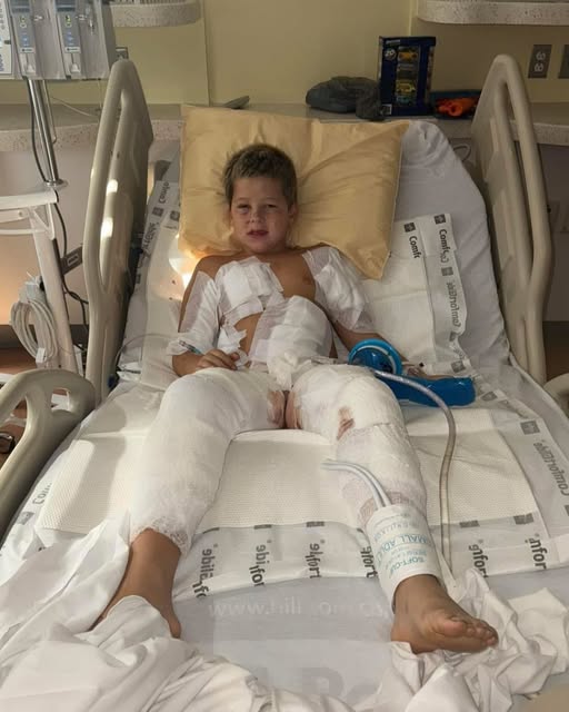 A Backyard Shattered: Braxton’s Fight for Life After a Brutal Attack.MH